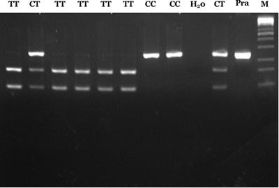 Is There Any Mosaicism in REarranged During Transfection Variant in Hirschsprung Disease’s Patients?